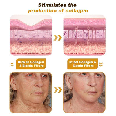 Bee Venom Wrinkle Repair Cream 🐝